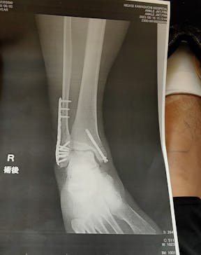 しらこばと水上公園（埼玉県公園緑地協会）に投稿された画像（2023/8/19）